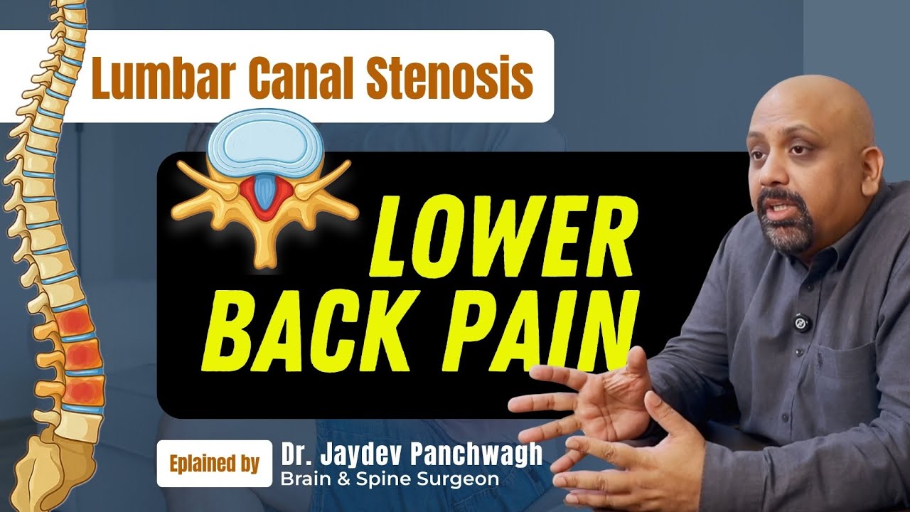 Understanding Lumbar Canal Stenosis